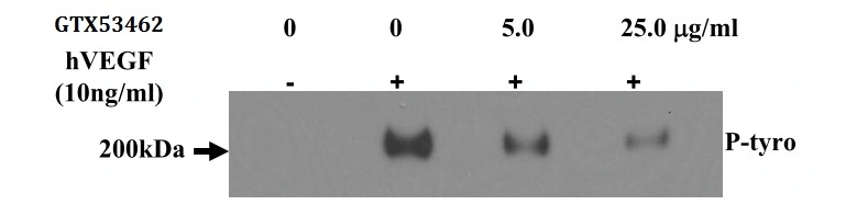 Activation assay analysis of HUVECs pre-treated with 5.0 and 25 ?g/ml GTX53462 VEGF Receptor 2 antibody [6B11] and then stimulated with rhVEGF (10ng/ml) for 30min. The phospho-VEGFR2 was detected by detected with IP-Western for P-Tyrosine.