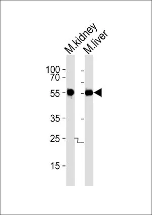 WB analysis of mouse kidney and liver tissue lysate using GTX53489 Casein Kinase I gamma 3 antibody. Loading : 35ug per lane Dilution : 1:1000 WB analysis of mouse kidney and liver tissue lysate using GTX53489 Casein Kinase I gamma 3 antibody. Loading : 35ug per lane Dilution : 1:1000