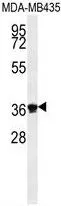 WB analysis of MDA-MB435 cell lysate (35ug/lane) using GTX53538 Exonuclease 5 antibody.