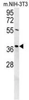 WB analysis of NIH-3T3 cell lysate (35ug/lane) using GTX53538 Exonuclease 5 antibody.