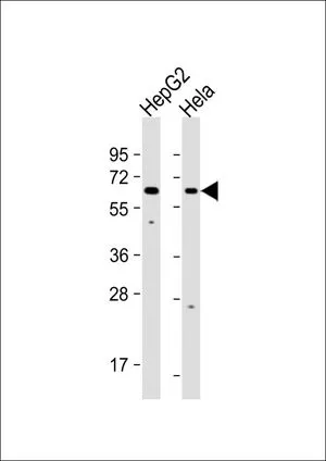 WB analysis of various samples using GTX53560 EHD1 antibody. Lane 1: HepG2 whole cell lysate Lane 2: HeLa whole cell lysate Loading : 20 microg per lane Dilution : 1:1000 WB analysis of various samples using GTX53560 EHD1 antibody. Lane 1: HepG2 whole cell lysate Lane 2: HeLa whole cell lysate Loading : 20 microg per lane Dilution : 1:1000