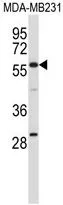 WB analysis of MDA-MB231 cell lysate (35ug/lane) using GTX53560 EHD1 antibody.
