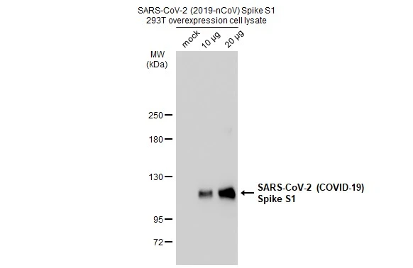 Non-transfected and transfected 293T whole cell extracts were separated by 5% SDS-PAGE, and the membrane was blotted with SARS-CoV-2 (COVID-19) Spike antibody (GTX135356) diluted at 1:5000. The HRP-conjugated anti-rabbit IgG antibody (GTX213110-01) was used to detect the primary antibody.
