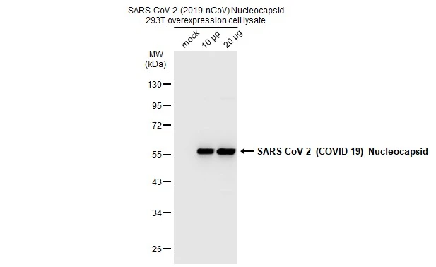 Non-transfected and transfected 293T whole cell extracts were separated by 10% SDS-PAGE, and the membrane was blotted with SARS-CoV-2 (COVID-19) nucleocapsid antibody (GTX135357) diluted at 1:5000. The HRP-conjugated anti-rabbit IgG antibody (GTX213110-01) was used to detect the primary antibody.