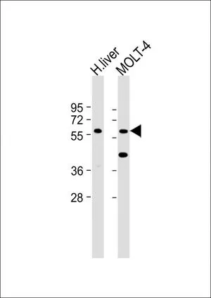 WB analysis of various samples using GTX53588 GXYLT2 antibody. Lane 1: Human liver tissue lysate Lane 2: MOLT-4 whole cell lysate Loading : 20 microg per lane Dilution : 1:2000 WB analysis of various samples using GTX53588 GXYLT2 antibody. Lane 1: Human liver tissue lysate Lane 2: MOLT-4 whole cell lysate Loading : 20 microg per lane Dilution : 1:2000