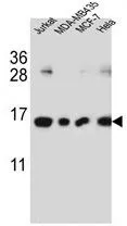 WB analysis of Jurkat, MDA-MB435, MCF-7, HeLa cell lysate (35ug/lane) using GTX53601 H2AFJ antibody. WB analysis of Jurkat, MDA-MB435, MCF-7, HeLa cell lysate (35ug/lane) using GTX53601 H2AFJ antibody.