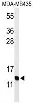WB analysis of MDA-MB435 cell lysate (35ug/lane) using GTX53607 GNRH2 antibody. WB analysis of MDA-MB435 cell lysate (35ug/lane) using GTX53607 GNRH2 antibody.