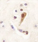 IHC-P analysis of human brain tissue using GTX53625 LHX6 antibody. IHC-P analysis of human brain tissue using GTX53625 LHX6 antibody.
