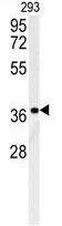 WB analysis of 293 cell lysate (35ug/lane) using GTX53635 Galectin-9B antibody. WB analysis of 293 cell lysate (35ug/lane) using GTX53635 Galectin-9B antibody.