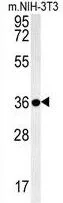 WB analysis of NIH-3T3 cell lysate (35ug/lane) using GTX53635 Galectin-9B antibody.