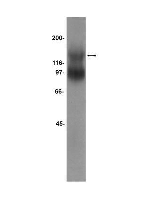 WB analysis of mouse brain membrane protein preparation using GTX53655 TrkB antibody. Dilution : 1microg/ml WB analysis of mouse brain membrane protein preparation using GTX53655 TrkB antibody. Dilution : 1microg/ml
