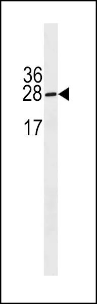 WB analysis of HepG2 cell lysate (35ug/lane) using GTX53664 IGLL5 antibody. WB analysis of HepG2 cell lysate (35ug/lane) using GTX53664 IGLL5 antibody.
