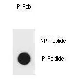 Dot Blot analysis of IKK beta phospho- or Non phospho-peptide using GTX53668 IKK beta (phospho Ser701) antibody. 50ng of Phospho-peptide or Non phospho-peptide per dot were adsorbed. Dilution : 0.6ug/ml