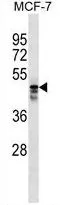 WB analysis of MCF-7 cell lysate (35ug/lane) using GTX53675 MUDENG antibody. WB analysis of MCF-7 cell lysate (35ug/lane) using GTX53675 MUDENG antibody.