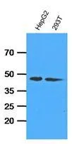 WB analysis of indicated lysates (35ug per lane) using ADK antibody at a dilution of 1:1,000. WB analysis of indicated lysates (35ug per lane) using ADK antibody at a dilution of 1:1,000.
