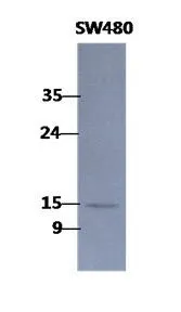 The WB analysis of SW480 (40ug) using COTL1 antibody at a dilution of 1:1,000. The WB analysis of SW480 (40ug) using COTL1 antibody at a dilution of 1:1,000.