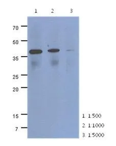 WB analysis of HeLa lysate (40ug) using CRLF2 antibody at the indicated dilution. WB analysis of HeLa lysate (40ug) using CRLF2 antibody at the indicated dilution.