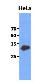 WB analysis of HeLa lysate (40ug) using GCLM antibody at a dilution of 1:3,000.