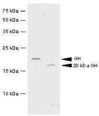 WB analysis of recombinant hGH and 20kDa hGH using Growth Hormone antibody [g3H5] at a dilution of 1:500.