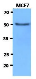 WB analysis of MCF7 lysate (40ug) using HEXA antibody at a dilution of 1:3,000. WB analysis of MCF7 lysate (40ug) using HEXA antibody at a dilution of 1:3,000.