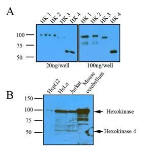 WB analysis of (A) recombinant protein (20ng or 100ng) of Hexokinase four isoform and (B) the indicated lysates (20ug) using Hexokinase antibody at a dilution of 1:1,000.