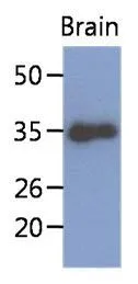 WB analysis of mouse brain lysate (40ug) using KLF7 antibody at a dilution of 1:1,000. WB analysis of mouse brain lysate (40ug) using KLF7 antibody at a dilution of 1:1,000.