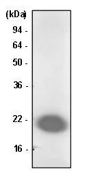 WB analysis of Jurkat lysate using Park7 / DJ-1 antibody at a dilution of 1:1,000. WB analysis of Jurkat lysate using Park7 / DJ-1 antibody at a dilution of 1:1,000.