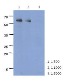 WB analysis of HeLa lysate (40ug) using PARP2 antibody at the indicated dilutions. WB analysis of HeLa lysate (40ug) using PARP2 antibody at the indicated dilutions.