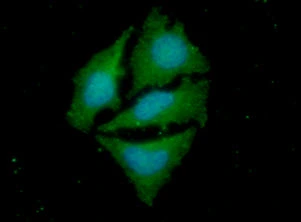 PPM1A antibody detects PPM1A protein in HeLa cells by immunofluorescent analysis. PPM1A antibody (GTX53766) dilution: 1:100 PPM1A antibody detects PPM1A protein in HeLa cells by immunofluorescent analysis. PPM1A antibody (GTX53766) dilution: 1:100