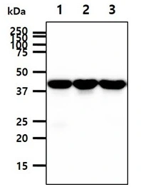 PPM1A antibody detects PPM1A protein by western blot analysis. 1. 40 microg Mouse kidney tissue lysate 2. 40 microg Mouse brain tissue lysate 3. 40 microg Mouse liver tissue lysate PPM1A antibody (GTX53766) dilution: 1:1000