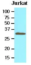 WB analysis of Jurkat lysate (30ug) using Tollip antibody at a dilution of 1:500. WB analysis of Jurkat lysate (30ug) using Tollip antibody at a dilution of 1:500.