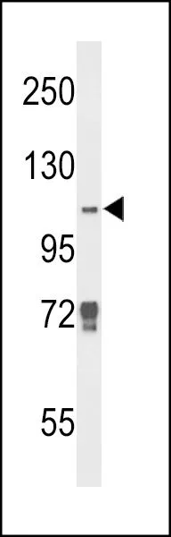 WB analysis of K562 cell lysate (35ug/lane) using GTX53804 KDM4B antibody. WB analysis of K562 cell lysate (35ug/lane) using GTX53804 KDM4B antibody.