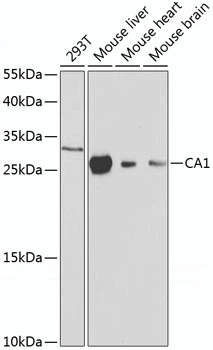 WB analysis of various sample lysates using GTX53905 Carbonic Anhydrase 1 antibody. Dilution : 1:1000 Loading : 25microg per lane WB analysis of various sample lysates using GTX53905 Carbonic Anhydrase 1 antibody. Dilution : 1:1000 Loading : 25microg per lane