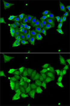 ICC/IF analysis of A549 cells using GTX53905 Carbonic Anhydrase 1 antibody. Blue : DAPI