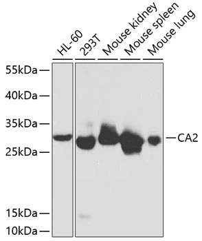 WB analysis of various sample lysates using GTX53908 Carbonic Anhydrase II antibody. Dilution : 1:1000 Loading : 25microg per lane WB analysis of various sample lysates using GTX53908 Carbonic Anhydrase II antibody. Dilution : 1:1000 Loading : 25microg per lane