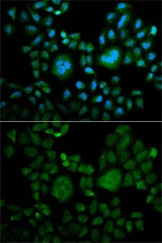 ICC/IF analysis of HeLa cells using GTX53908 Carbonic Anhydrase II antibody. Blue : DAPI