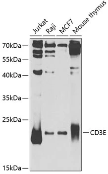 WB analysis of various sample lysates using GTX53910 CD3 epsilon antibody. Dilution : 1:1000 Loading : 25microg per lane WB analysis of various sample lysates using GTX53910 CD3 epsilon antibody. Dilution : 1:1000 Loading : 25microg per lane