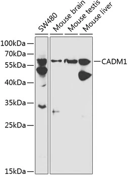 WB analysis of various sample lysates using GTX53913 SynCAM antibody. Dilution : 1:1000 Loading : 25microg per lane WB analysis of various sample lysates using GTX53913 SynCAM antibody. Dilution : 1:1000 Loading : 25microg per lane