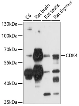 WB analysis of various sample lysates using GTX53923 CaMKIV antibody. Dilution : 1:1000 Loading : 25microg per lane WB analysis of various sample lysates using GTX53923 CaMKIV antibody. Dilution : 1:1000 Loading : 25microg per lane