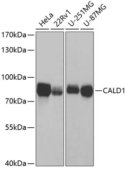 WB analysis of various sample lysates using GTX53924 Caldesmon antibody. Dilution : 1:1000 Loading : 25microg per lane WB analysis of various sample lysates using GTX53924 Caldesmon antibody. Dilution : 1:1000 Loading : 25microg per lane