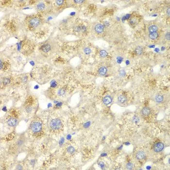 IHC-P analysis of human liver damage tissue using GTX53924 Caldesmon antibody. Dilution : 1:100
