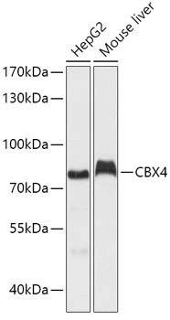 WB analysis of various sample lysates using GTX53928 CBX4 antibody. Dilution : 1:1000 Loading : 25microg per lane