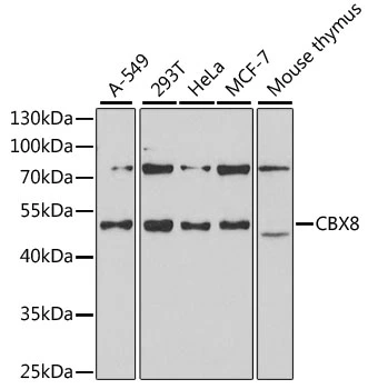 WB analysis of various sample lysates using GTX53929 CBX8 antibody. Dilution : 1:1000 Loading : 25microg per lane WB analysis of various sample lysates using GTX53929 CBX8 antibody. Dilution : 1:1000 Loading : 25microg per lane
