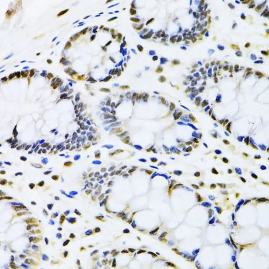 IHC-P analysis of human colon tissue using GTX53929 CBX8 antibody. Dilution : 1:100