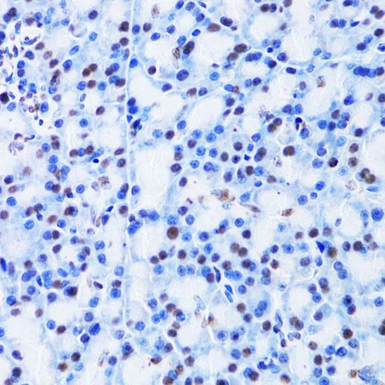 IHC-P analysis of rat pancreas tissue using GTX53929 CBX8 antibody. Dilution : 1:100