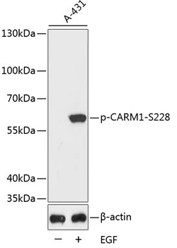 WB analysis of A431 cell lysate using GTX53931 CARM1 (phospho Ser228) antibody. Loading : 25microg per lane WB analysis of A431 cell lysate using GTX53931 CARM1 (phospho Ser228) antibody. Loading : 25microg per lane