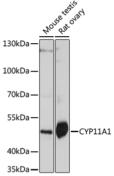WB analysis of various sample lysates using GTX53941 CYP11A1 antibody. Dilution : 1:1000 Loading : 25microg per lane WB analysis of various sample lysates using GTX53941 CYP11A1 antibody. Dilution : 1:1000 Loading : 25microg per lane