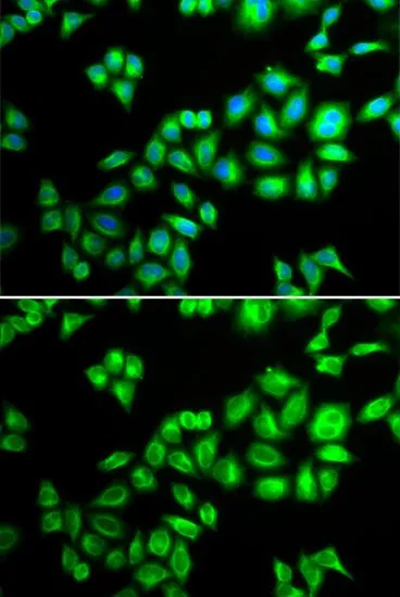ICC/IF analysis of HeLa cells using GTX53945 Cullin 1 antibody. Blue : DAPI