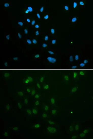 ICC/IF analysis of MCF7 cells using GTX53946 Chk2 antibody. Blue : DAPI ICC/IF analysis of MCF7 cells using GTX53946 Chk2 antibody. Blue : DAPI