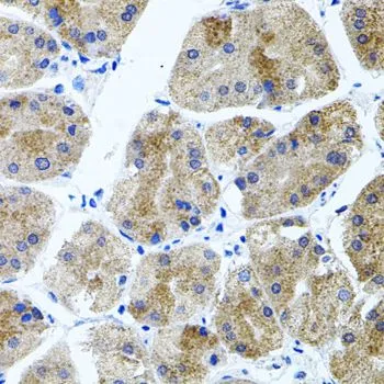 IHC-P analysis of human stomach tissue using GTX53952 CDH23 antibody. Dilution : 1:100 IHC-P analysis of human stomach tissue using GTX53952 CDH23 antibody. Dilution : 1:100